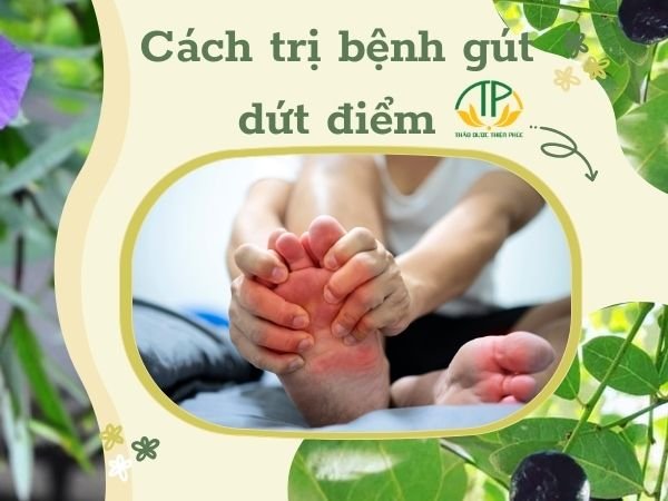 Cách trị bệnh gút dứt điểm